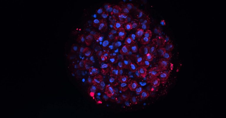 Red and blue organoid