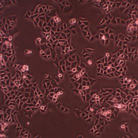 A microscope image depicts HeLa cells, which were identified to have contaminated major cell lines by the 1960s